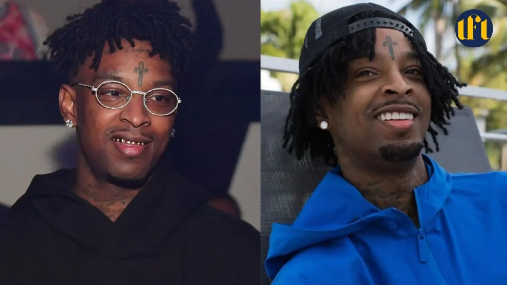 21-savage-veneers-before-and-after-results