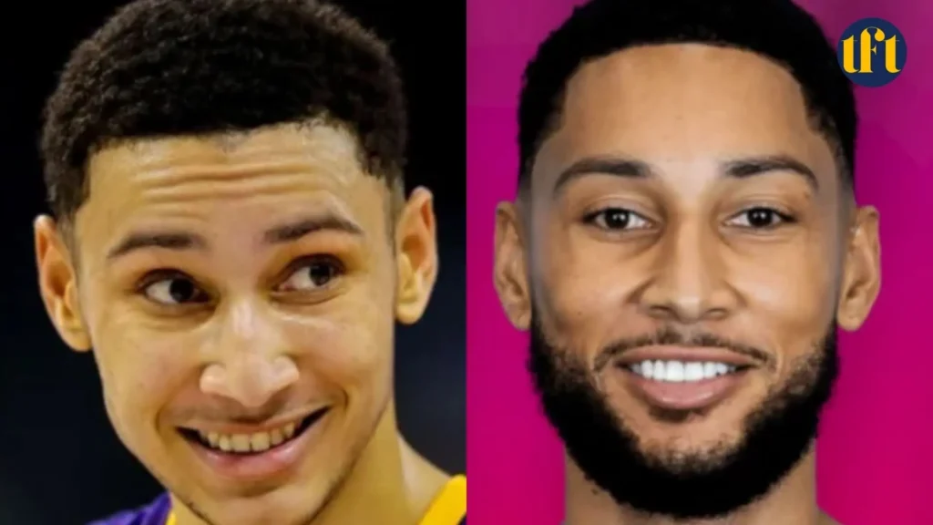 ben-simmons-veneers-before-and-after-results