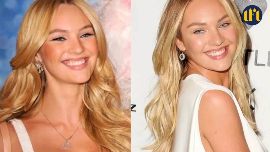 candice-swanepoel-veneers-before-and-after-results