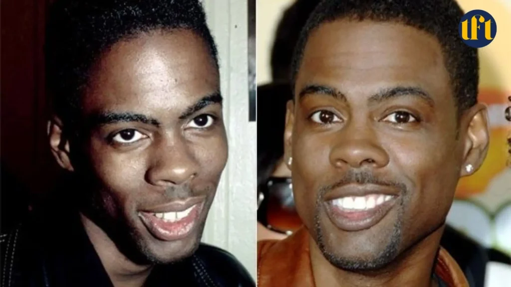 chris-rock-veneers-before-and-after-results