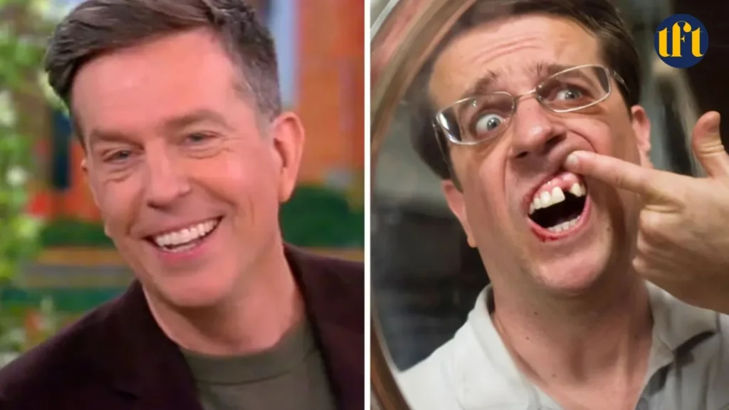 ed-helms-veneers-before-and-after-results