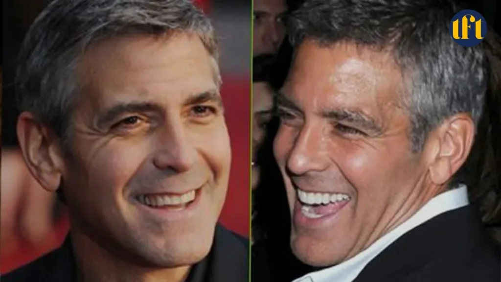 george-clooney-veneers-before-and-after-results