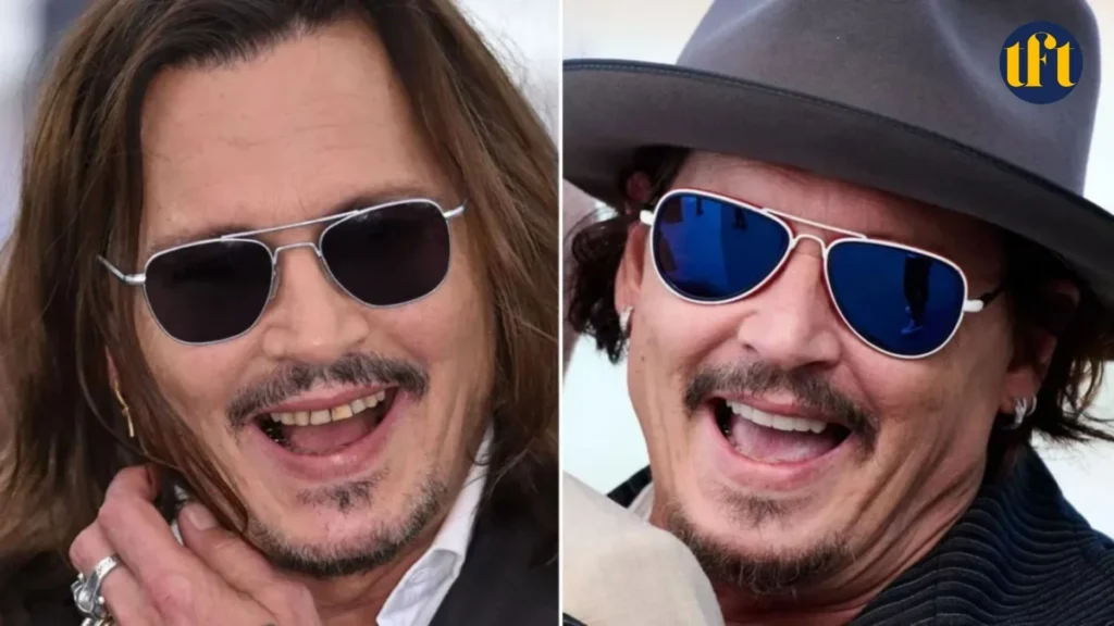 johnny-depp-veneers-before-and-after-results