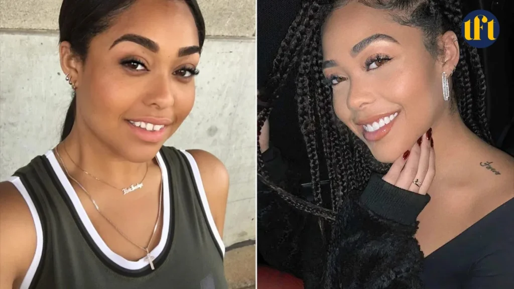 jordyn-woods-veneers-before-and-after-results
