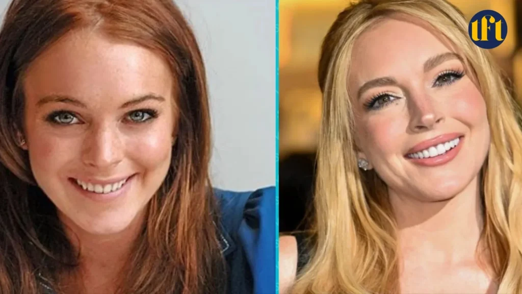 lindsay-lohan-veneers-before-and-after-results