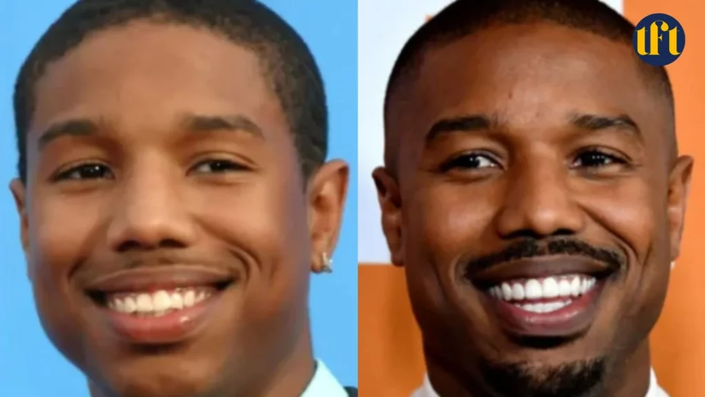 michael-b-jordan-veneers-before-and-after-results