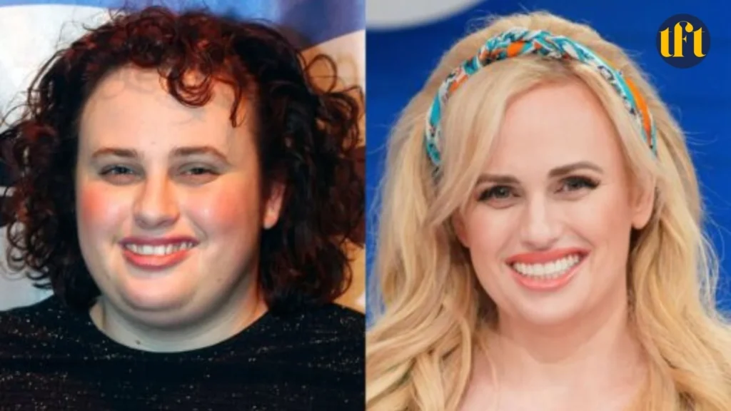 rebel-wilson-veneers-before-and-after-results