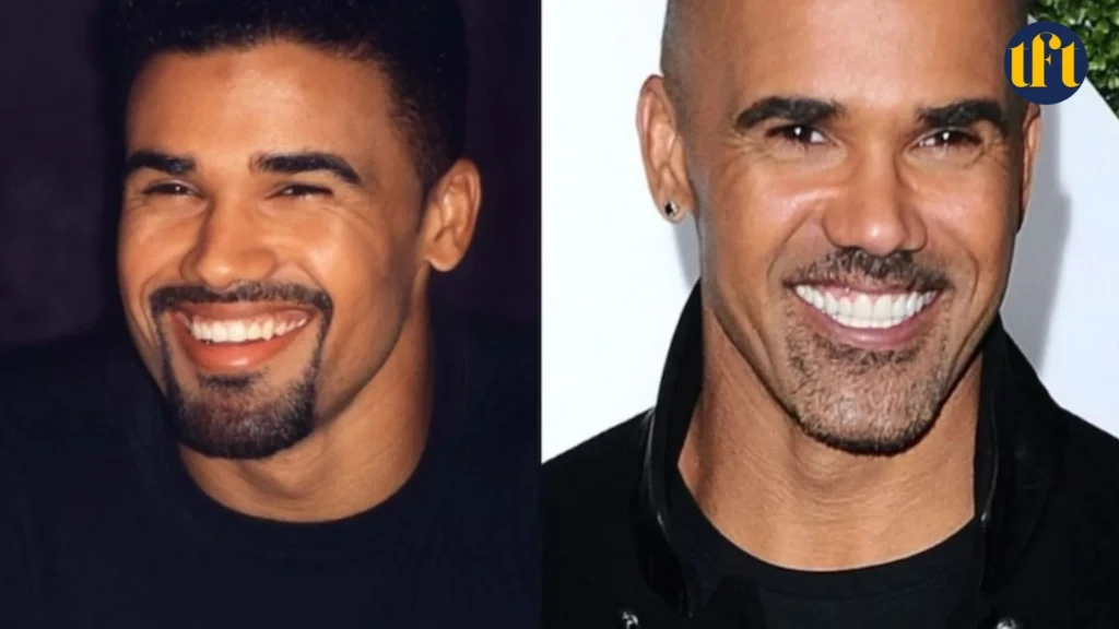 shemar-moore-veneers-before-and-after-results