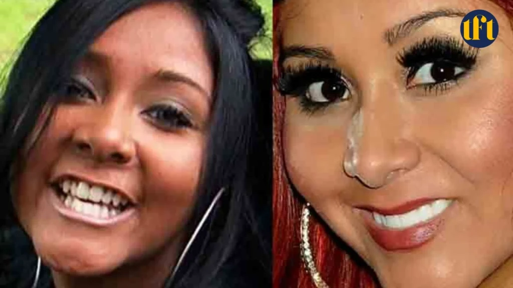 snooki-veneers-before-and-after-results