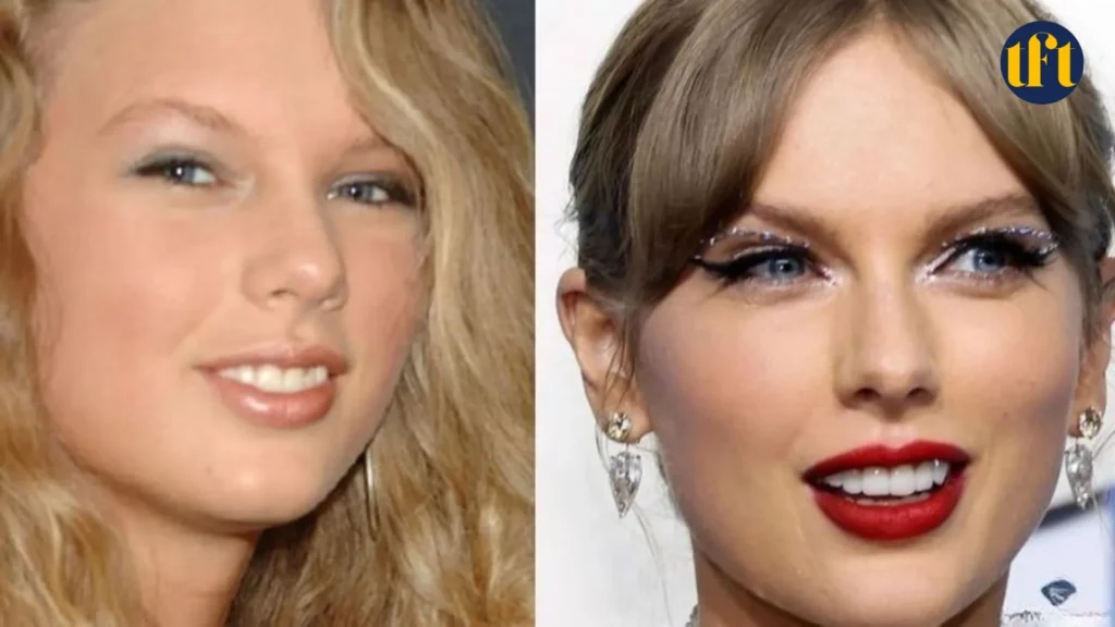 taylor-swift-veneers-before-and-after-results